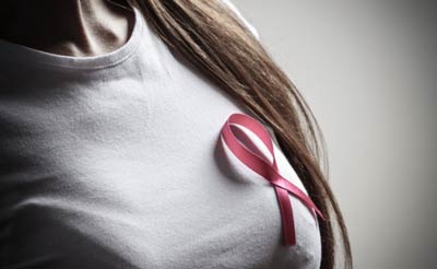 乳腺癌易感基因检测，提早预防癌症的发生  